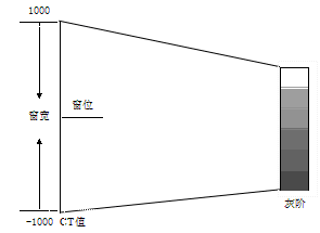 窗宽窗位对基于互信息的医学图像配准方法的影响